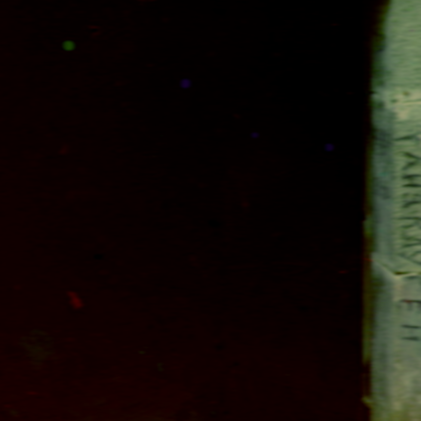 Firflyer - Stitches (2022)